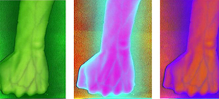 高光譜成像技術(shù)在生物醫(yī)學方向的新應(yīng)用